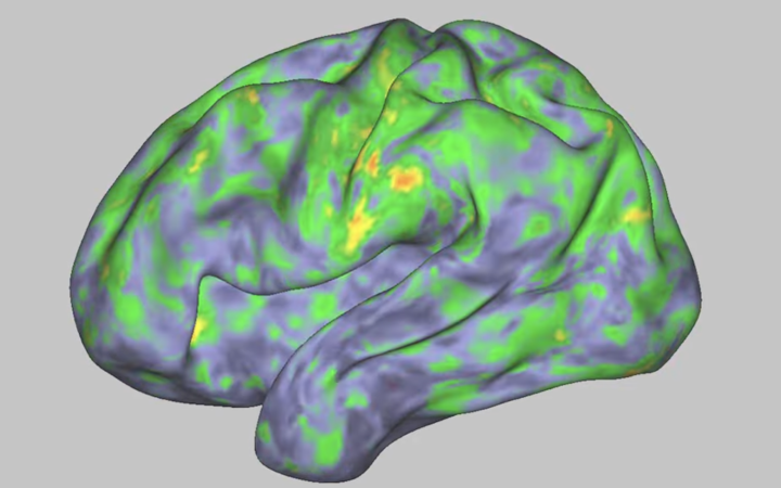 Парадокс невизначеності: чому наш мозок схильний до вибору найгіршого варіанту і як можна це виправити.