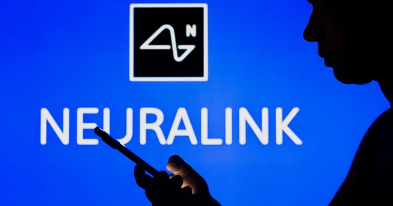 Neuralink, компанія, заснована Ілоном Маском, стартувала тестування мозкових імплантів на території Великої Британії. — Delo.ua