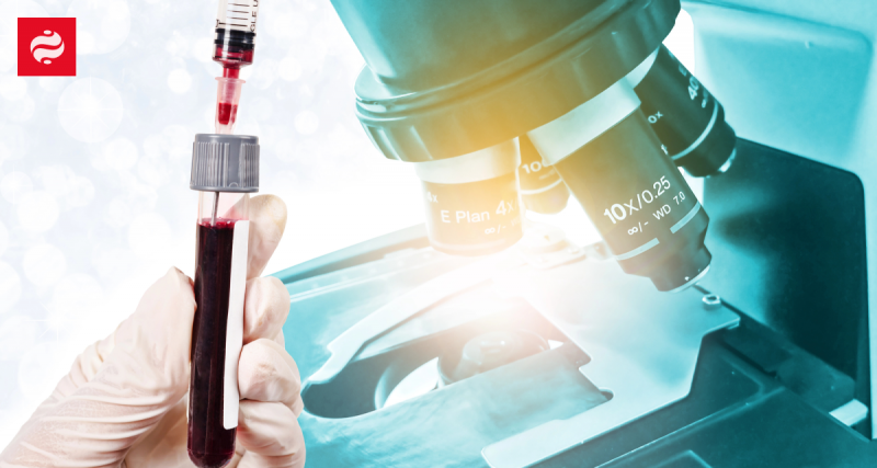 Точність перевищує 90%: вчені проводять випробування кров'яного тесту для виявлення раку яєчників - як це вплине на діагностику хвороби.